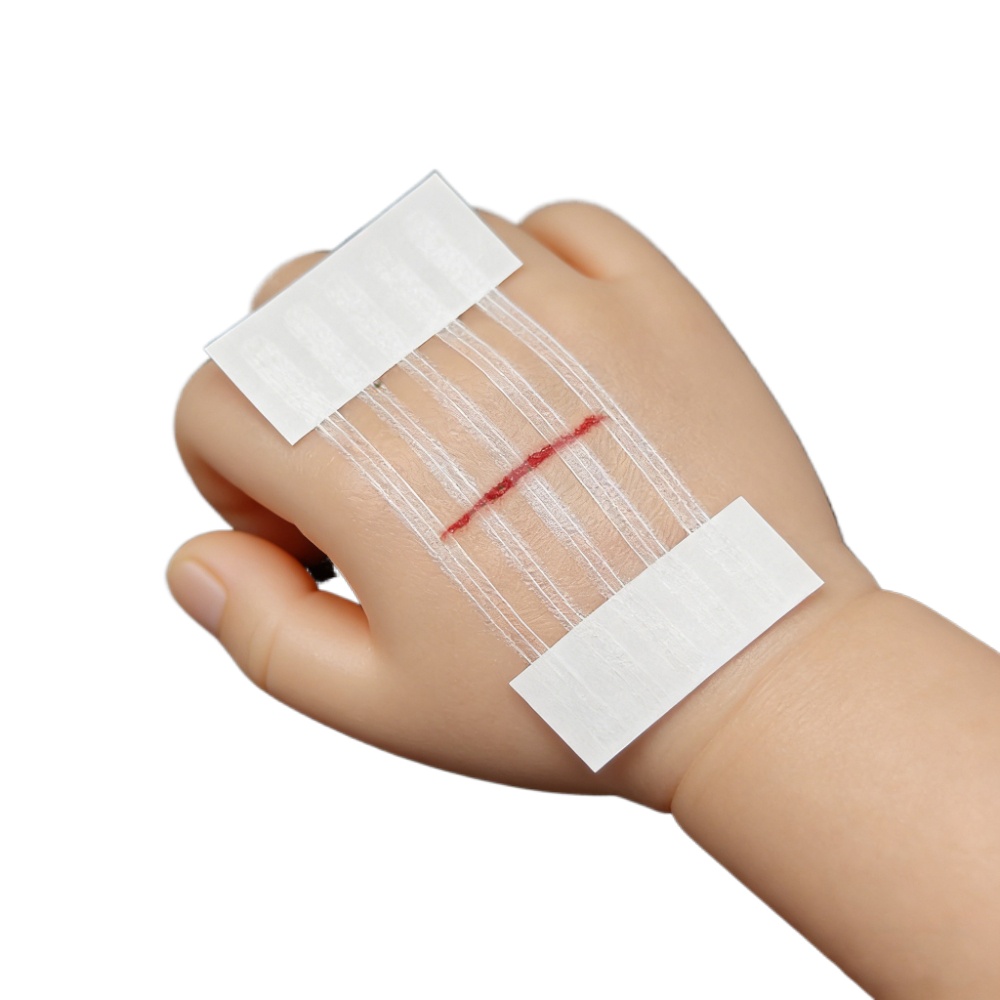 5 Strips Wound Skin Closure St - Medical Label のレビューと価格