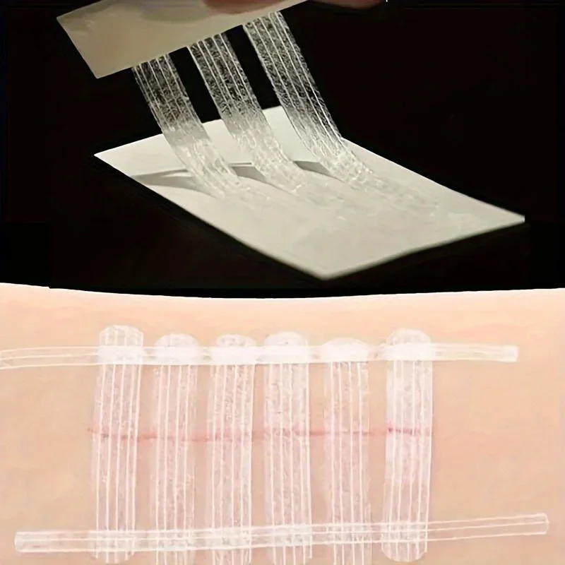 5 Strips Wound Skin Closure St - Medical Label のレビューと価格